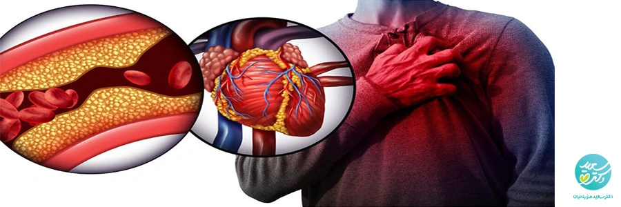 اهمیت شناخت چربی خون بالا و راهکارهای کنترل آن